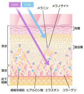 光老化の怖さ