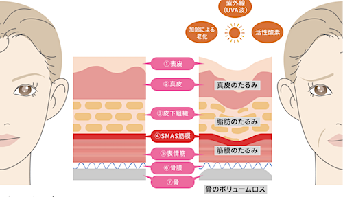 たるみの原因と改善法